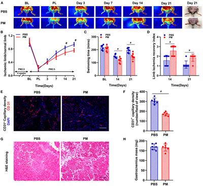 CARD9 deficiency improves the recovery of limb ischemia in mice with ambient fine particulate matter exposure